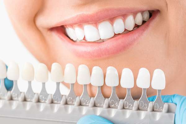 Ask a Cosmetic Dentist: What Are Veneers from Dental Care of Madison in Madison, MS