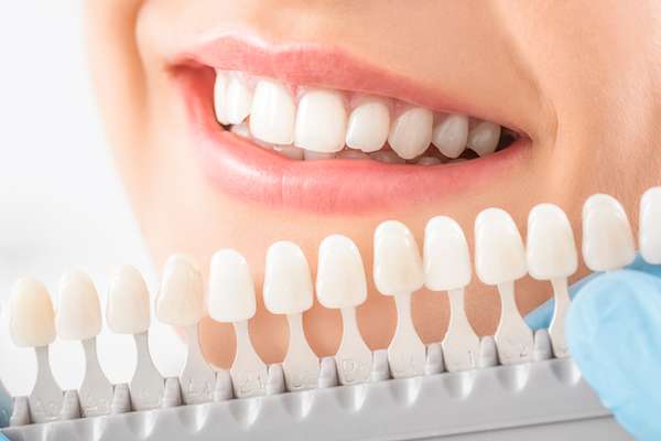 Caring for Veneers After a Cosmetic Dentist Treatment from Dental Care of Madison in Madison, MS