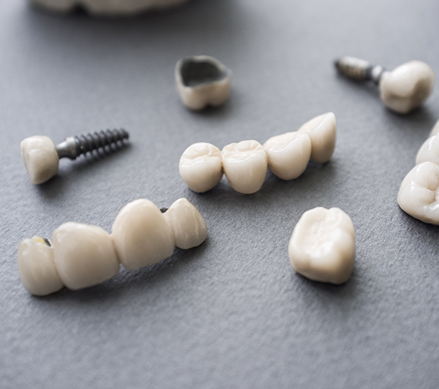 Madison The Difference Between Dental Implants and Mini Dental Implants