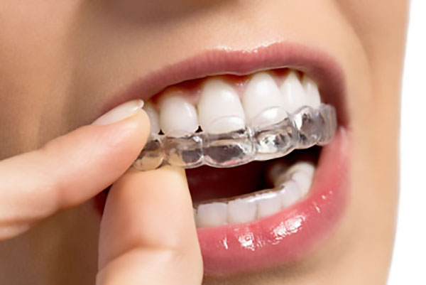 Will Invisalign® Take The Place Of Teeth Straightening With Regular Braces?